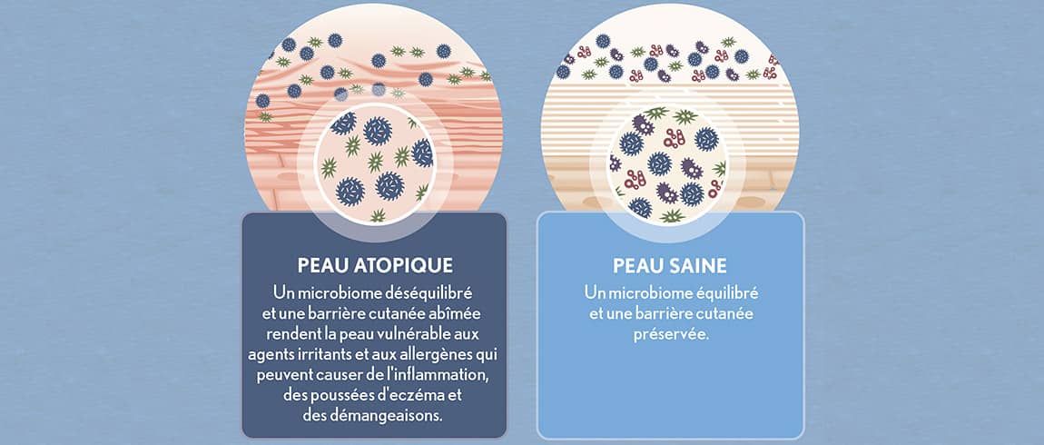 Recherche d’AVEENO® sur le microbiome cutané